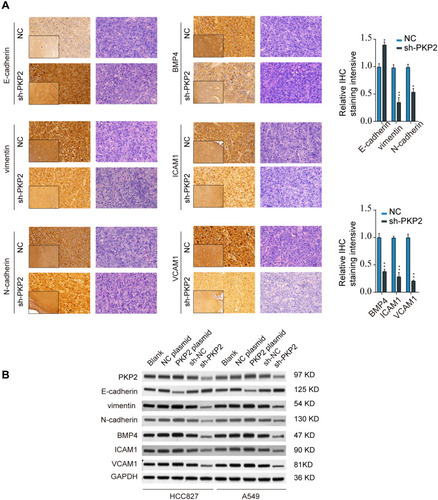 Figure 7 Knockdown of PKP2 suppressed EMT and focal adhesion in LUAD. (A) IHC staining of EMT markers (E-cadherin, Vimentin, and N-cadherin) and focal adhesion markers (BMP4, ICAM1, and VCAM1) was performed using xenograft tumor sections from NC or sh-PKP2 groups. (B) HCC827 or A549 cells were transfected with sh-NC, sh-PKP2 or left untreated. The protein expression of EMT and focal adhesion markers was analyzed by Western blot. *P < 0.05, **P < 0.01.