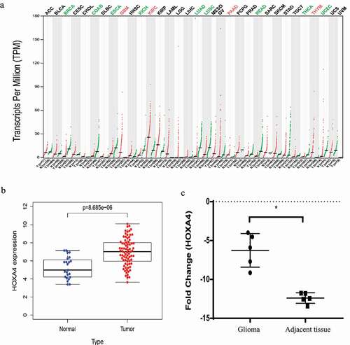 Figure 1. (a) Expression levels of HOXA4 in various human tumor tissue samples. The color of the tumor type represents the level of HOXA4 expression in the tumor: red denotes high expression, while green denotes low expression. (b) Seventy-seven glioma tissue specimens were compared with twenty-three standard brain tissue specimens obtained from the GSE4290 dataset. The expression level of HOXA4 in glioma tissue was significantly higher than that in normal brain tissue. (c) Results of RT-qPCR comparison of HOXA4 levels in five glioma tissue samples and five adjacent brain tissue samples. The RT-qPCR results verified that HOXA4 was expressed at higher levels in glioma tissue than in normal tissue.