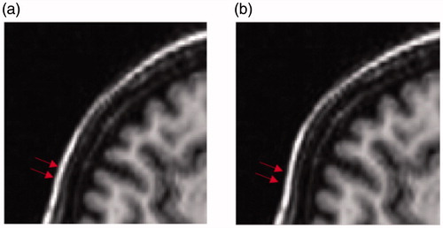 Figure 6. Image after deform (left) and image before deform (right).