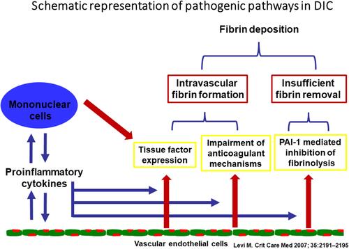 Figure 4 Schematic representation of pathogenic pathways in DIC.