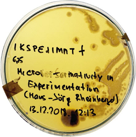 Petri dish with yeast cell cultures from saliva samples, Microbial Keywording by Spiess/ Strecker, as part of the Applied Microperformativity festival, AIL Vienna, December 2018. Courtesy of the artists. Photo © Peter Mayr