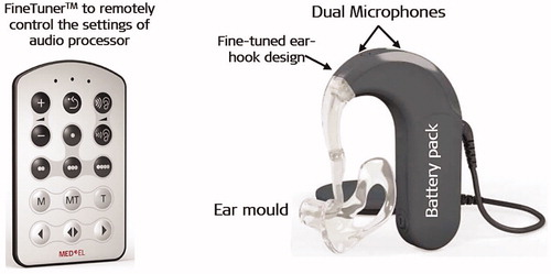 Figure 31. SONNET® EAS™ audio processor (image courtesy of MED-EL).