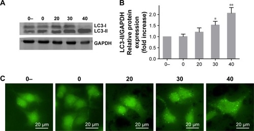 Figure 6 Au–Ag@PDA NPs triggered autophagy in cancer cells in a dose-dependent manner after being irradiated by an 808 nm laser with a power density of 1 W/cm2 for 4 minutes.Notes: (A) Expression of LC3 protein in T24 cells treated with different concentrations of Au–Ag@PDA NPs determined by Western blot analysis. (B) Quantification of LC3-II/GAPDH compared with the 0- control group (mean±SD; n=3). (C) GFP-LC3 protein and GFP-LC3 punctate foci visualized by the High-Content Imaging System in GFP-LC3 stably transfected HeLa cells treated with different concentrations of Au–Ag@PDA NPs. (0-: 0 µg+no laser, 0: 0 µg+laser, 20: 20 µg+laser, 30: 30 µg+laser, 40: 40 µg+laser). *P<0.05, **P<0.01 vs 0 group.Abbreviations: NPs, nanoparticles; PDA, polydopamine.