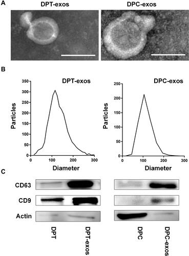 Figure 1 Identification of exosomes. (A) The morphology of DPT-exos and DPC-exos; (B) the diameter distribution of DPT-exos and DPC-exos; (C) surface markers of DPT-exos and DPC-exos. Scale bars: 100 nm.
