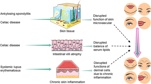 Figure 4 The clinical relevance of facial aging in autoimmune diseases.