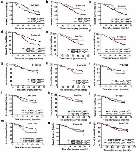 Figure 2. OS curves from ANT and TM in HCC. OS curves were plotted in GraphPad Prism 5. The horizontal axis showed time after surgery and the vertical axis showed overall survival rates by the corresponding time. Two sets of data (low vs. high) were represented by black and red curve, respectively. P < .05 was considered statistically significant. OS, overall survival; ANTlow, low expression of indicated biomarkers in ANT; ANThigh, high expression of indicated biomarkers in ANT; TMlow, low expression of indicated biomarkers in TM; TMhigh, high expression of indicated biomarkers in TM; ANT+TMlow, low expression of indicated biomarkers in both ANT and TM; ANT+TMhigh, high expression of indicated biomarkers in both ANT and TMTTR curves from ANT and TM in HCC TTR curves were plotted in GraphPad Prism 5. The horizontal axis showed time after surgery and vertical axis showed probability of recurrence. Two sets of data (low vs. high) were represented by black and red curve, respectively. P < .05 was considered statistically significant. TTR, time to recurrence; ANTlow, low expression of indicated biomarkers in ANT; ANThigh, high expression of indicated biomarkers in ANT; TMlow, low expression of indicated biomarkers in TM; TMhigh, high expression of indicated biomarkers in TM; ANT+TMlow, low expression of indicated biomarkers in both ANT and TM; ANT+TMhigh, high expression of indicated biomarkers in both ANT and TM