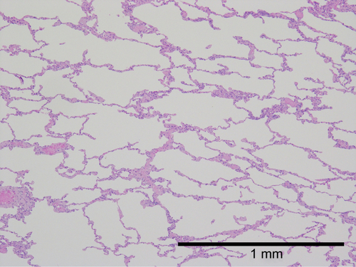 Figure S1 High-power photograph of a normal lung.Notes: The parenchyma of normal lung shows little fibrotic change compared with SRIF. The architectural destruction and emphysematous change are absent in normal lung.Abbreviation: SRIF, smoking-related interstitial fibrosis.