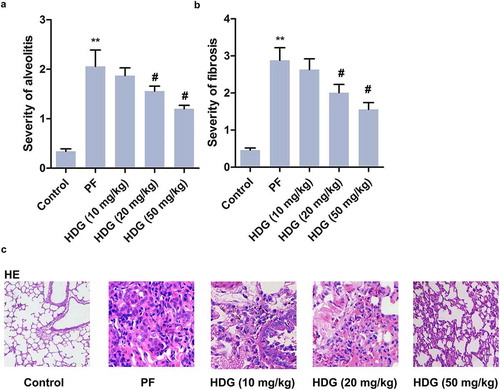 Figure 2. HDG improved the pathological lesion induced by BLM in PF rats.Rats were randomly divided into 5 groups (n = 10): Control group, PF group, HDG (10 mg/kg) group, HDG (20 mg/kg) group and HDG (50 mg/kg) group. a. Alveolitis score. b. Fibrosis score. c. Pathological lesion was assessed by HE staining. (** p < 0.01 vs control group; # p < 0.05, ## p < 0.01 vs PF group)