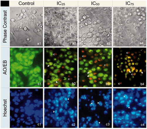 Figure 5. The effect of IC25, IC50 and IC75 concentrations of RS-AgNPs on SKOV3 cells for 24 h exposure (400×). (a) Phase contrast microscopy, (b) AO/EB staining and (c) Hoechst staining. Intact cells in control (a1, b1 and c1). Cells in the circle of AO/EB staining represents viable cells (b1), white arrows represent early apoptotic (b2, b3 and b4) and black arrow represents late apoptotic cells (b2, b3 and b4). White arrow head in Hoechst staining indicates as an early and late apoptosis (c2, c3 and c4).