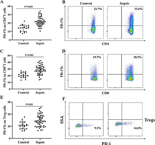 Figure 1 Comparison of the expression of PD-1 on T lymphocyte subsets in patients with sepsis and healthy individuals. (A, C and E) Representative dot plot of the comparison of PD-1 expression on CD4+ T cells, CD8+ T cells and Tregs in septic patients and healthy individuals. (B, D and F) Typical flow chart of the differences in PD-1 expression on the surface of CD4+ T cells, CD8+ T cells and Tregs between septic patients and healthy individuals. The data were obtained from 48 patients with sepsis (48 data points) and 20 healthy individuals (20 data points), each of which represents a single individual. P<0.05 indicates a statistically significant difference.