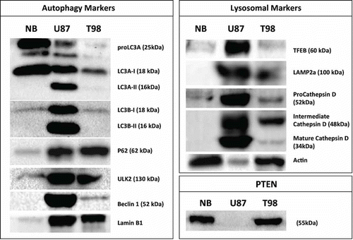 Figure 7. Western blot analysis of autophagosomal (LC3A, LC3B, p62, ULK2, Beclin 1), lysosomal (TFEB, LAMP2a, Cathepsin D) markers and PTEN expression, in normal human brain and the 2 glioblastoma cell lines (U87 and T98) under optimal culture conditions.