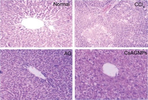 Figure 3 Histopathological changes of liver cytoarchitecture after various treatments, magnification 400×, normal liver, CCl4-treated liver, AG-treated liver, CsAGNP-treated liver.Abbreviations: AG, andrographolide; CsAGNPs, chitosan-modified AG nanoparticles.
