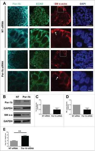 FIGURE 7. Par-1b is Required for the Morphogenesis and Differentiation of Myoepithelial Cells in the Developing Mouse SMG. (A) ICC was performed on E13 glands grown in culture for 96 hours that were treated with either NT siRNA or Par-1b siRNA (500nM) to detect Par-1b (cyan), ECAD (green), and SM α-actin (red), with DAPI staining (blue). The lower panel of images are zooms from boxed area in the top panel. A significant decrease in the number of SM α−actin-positive cells was observed following Par-1b siRNA treatment as well as an increase in ECAD+/SM α−actin+ cell height. Scale bars, 10µm top panels, 2µm bottom panels. (B) Western analysis was performed on whole glands following 96-hour culture with Par-1b or NT siRNA to detect the same proteins relative to GAPDH. Representative Westerns are shown. n ≥ 3 experiments for each blot. (C) Par-1b siRNA-induced knockdown was confirmed. (D) Par-1b siRNA treatment led to a reduction in the levels of SM α-actin relative to NT siRNA. (E) The height (µm) of individual epithelial cells expressing SM α-actin were measured in glands treated with NT siRNA or Par-1b siRNA for 96 hours. The height of the ECAD+/SM α-actin+ Par-1b siRNA-treated cells was significantly greater than that of ECAD+/SM α-actin+ NT siRNA-treated cells (n ≥ 25 cells/condition). (** p ≤ 0.01).
