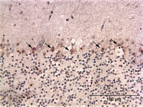 Figure 9.  Immunoperoxidase-stained cerebellum of a red-bellied parrot (Case 1583) showing the presence of cells containing ABV N-protein within the Purkinje layer. Purkinje cells appear to be absent or shrunken in this section. Arrows point to stained cells.