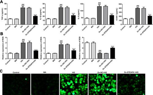 Figure 3 Overexpression of STEAP4 attenuated the inflammatory and oxidative stress induced by HG. (A) The expression of inflammatory factors TNF-a, IL-1β, IL-6, ICAM-1 was detected by ELISA. (B). ROS kit, MDA kit and SOD kit were used to detect the expression of ROS, MDA and SOD. (C). ROS fluorescence kit was used to detect ROS levels. n=5, ***p<0.001 vs Control; ###p<0.01 vs MA; ΔΔΔp<0.001 vs Ov-NC+HG.Abbreviations: Ov-NC, overexpression-NC; Ov-STEAP4, overexpression-STEAP4; HG, high glucose.