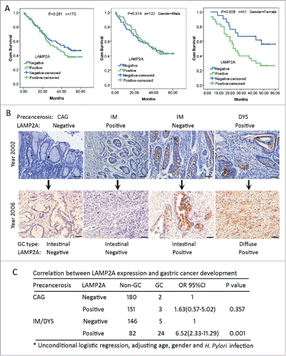 Figure 6. LAMP2A expression in GC and noncancerous tissues with regard to prognosis and GC development. (A) Kaplan-Meier curves for postoperative survival of all the GC patients (left), of male GC patients (middle) and of female GC patients (right), according to LAMP2A positivity. The medium survival times of LAMP2A-negative and positive patients were compared by log-rank test, P < 0.05 was considered to be statistically significant. (B) Immunostaining of LAMP2A in gastric precancerous tissues and the corresponding GC tissues. Scale bar (in black): 200 µm. (X 200). (C) Correlation between LAMP2A positivity and GC development risk of gastric precancerosis was analyzed by unconditional logistic regression, P < 0.05 was considered to be statistically significant.