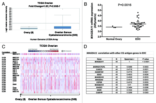 Figure 2.MAGEA11 expression in epithelial ovarian cancer (EOC). (A) Oncomine analysis of MAGEA11 mRNA expression in TCGA data Citation63. Fold change, P-value, and microarray platform is indicated. Data presentation is as described in Figure 1. (B) Oncomine analysis of the genes most closely correlated with MAGEA11 in TCGA data. (C) MAGEA11 mRNA expression was determined in three normal ovary samples and 40 EOC samples using Affymetrix HG 1.0ST microarrays. Two-tailed t-test results are shown. (D) Expression of MAGEA11 and other CG antigen genes was determined by Affymetrix microarray, as described in (C). Spearman test r values and P-values for correlation with MAGEA11 are shown.