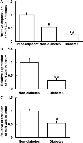 Figure 4. Relative expression of miR-30b in PC. (A) Relative expression of miR-30b in tumor tissues from PC patients with or without diabetes and tumor-adjacent tissues from all PC patients. *p < 0.05 compared with tumor-adjacent tissues. #p < 0.05 compared with tumor tissues from PC patients without diabetes. Relative expression of miR-30b in serum (B) and urine (C) from PC patients with or without diabetes. *p < 0.05 and **p < 0.01 compared with PC patients without diabetes. qRT-PCR was used to determine the expression of miR-30b.
