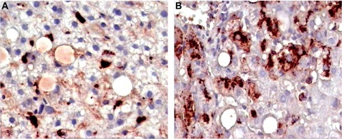 Figure 6 Pre- and postbiopsy examination of tissues at time zero and after 6 months of a patient on Ambovex® treatment therapy.