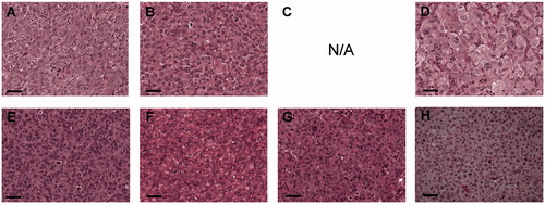 Figure 2. Xenograft tumors were sectioned and stained with hematoxylin and eosin. (A) LU-TC-1, (B) LU-TC-2, (C) N/A due to no xenograft tumor take of LU-TC-7, (D) LU-TC-8, (E) LU-TC-10, (F) LU-TC-12, (G) LU-TC-14, and (H) LU-TC-15. Bars indicate 100 µm.