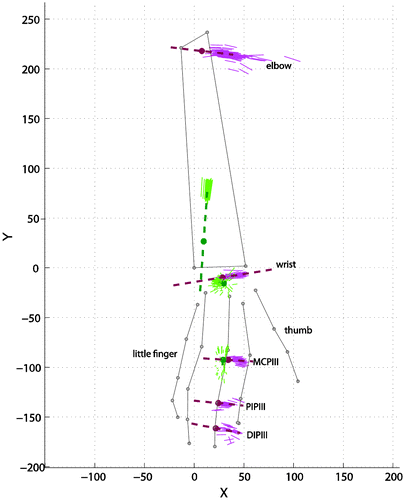 Figure 5. IHA and estimated joint axis for the middle finger. Green solid lines: instantaneous abduction-adduction and pro-supination axis, purple solid lines: instantaneous flexion axis. Dashed lines, estimated joint axes. Dorsal view of the hand and forearm.