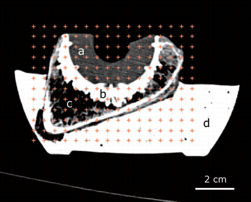 Figure 4. The counting grid placed on a CT image of cadaveric bone. Opera cup (a), cement (b), cadaveric bone (c), and Vel-Mix stone (d).