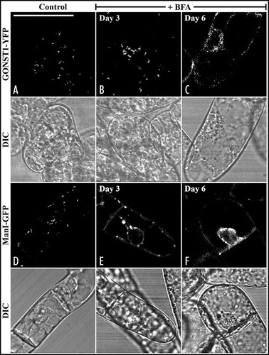 Figure 2 The formation of BFA-induced Golgi aggregates in transgenic tobacco BY-2 cells expressing either GONST1-YFP or Man1-GFP is stages dependent. Day-3 and Day-6 transgenic tobacco BY-2 cells expressing either GONST1-YFP (B and C) or Man1-GFP (right panel) were treated with BFA at 10 µg/ml for 1 hr before confocal image collection. The patterns of fluorescent signals before BFA treatments in these two transgenic cell lines were also shown (A and D). DIC = differential interference contrast images showing the morphology of the tested cells. Bars = 50 µm.