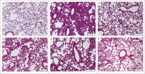 Figure 5. Representative histopathological images of lungs, 45 days post Mtb challenge (A) Saline, (B) infection control, (C) BCG, (D) Advax4, (E) Advax4 + CMX, (F) Advax4 + ECMX. H&E staining, x100 magnification. Inflammatory injury reduction is observed 45 days after challenge in the Advax4 + ECMX group.