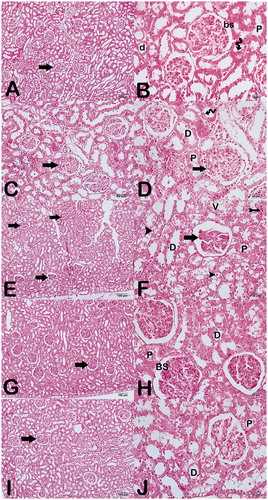 Figure 2. Light microscopic photographs from kidney tissue sections stained with H&E.