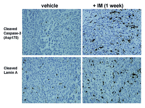 Figure 4. IM treatment causes higher levels of apoptotic markers, cleaved caspase-3 and cleaved Lamin A, in GIST xenografts. Immunohistochemistry of GIST-T1 xenografts, treated with vehicle (left column) or with IM (right column) for one week, for cleaved caspase-3 (top row) and cleaved Lamin A (bottom row).