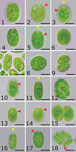 Figs 1–18. Morphology and reproduction of studied strains. Figs 1–3. Ostravamonas chlorostellata CAUP G 1401. Figs 4–6. O. chlorostellata SAG 12.72. Figs 7–9. Chloromonas gracillima SAG 25.87. Figs 10–12. O. meslinii SAG 75.81. Figs 13–15. O. tenuiincisa CCAP 11/108. Figs 16–18. C. reticulata CAUP G 1302. Yellow arrowheads indicate papilla, red arrowheads indicate eyespot. Scale bars = 10 µm.