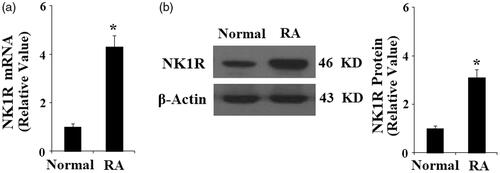Figure 2. Expression of neurokinin 1 receptor (NK-1R) is increased in rheumatoid arthritis (RA)-FLSs as compared to normal FLSs. (a). Real-time PCR analysis of NK-1R; (b). Western blot analysis of NK-1R (*, p < .01 vs. vehicle group).