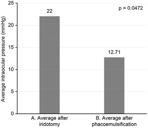 Figure 4 Average intraocular pressure levels after iridotomy and phacoemulsification. (A) Average after iridotomy. (B) Average after phacoemulsification.