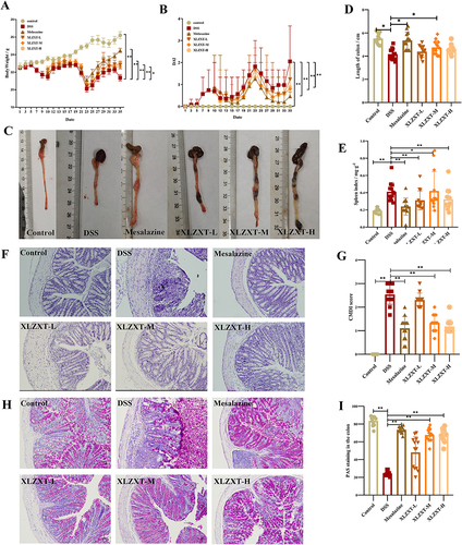 Figure 2 XLZXT improves the symptoms of DSS-induced UC. (A) Colon images of different groups. (B) Histogram statistical of colon length. (C) Curve chart of mice body weight across time. (D) Curve chart of DAI scores of mice. (E) Histogram statistical of spleen index. (F) Representative of H&E staining of colonic sections, ×200. The black arrow means the site of neutrophil immersion. (G) Histogram statistical of CMDI scores. (H) Representative of PAS staining of colonic sections, ×200. (I) Histogram statistical of PAS staining in the colon. Data are expressed as mean ±SD (n=12 in control group, n=13 in other groups). *P<0.05, **P<0.01.