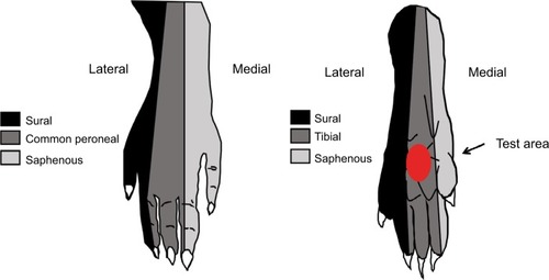 Figure 2 Neural receptive field and the area in rat plantar for the behavior test.