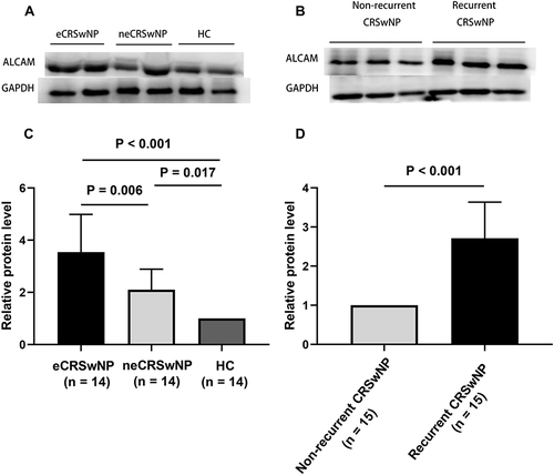 Figure 9 The ALCAM protein expression in the tissue based on WB. (A) WB images of ALCAM among eCRSwNP, neCRSwNP and HC groups. (B) WB images of ALCAM between the recurrent CRSwNP and non-recurrent CRSwNP groups. (C) comparison of ALCAM relative protein level among eCRSwNP, neCRSwNP and HC groups. (D) comparison of ALCAM relative protein level between the recurrent CRSwNP and non-recurrent CRSwNP groups.