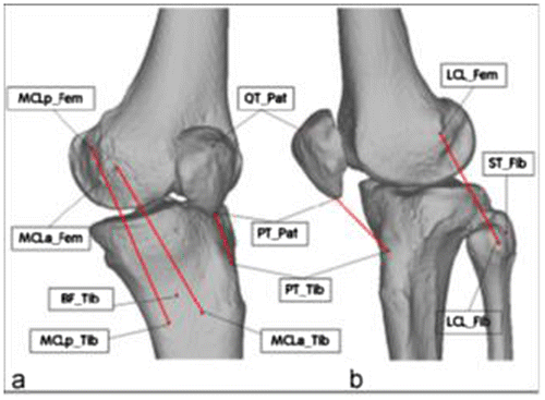 Figure 1. Bone models and position of the soft tissues insertion points considered in this study: a) medial view; b) lateral view. Tibia and fibula were considered as rigid bodies; the centroid of the insertion area of the ligaments (shown as red lines) was used as the best approximation of the position of the respective insertion point: LCL_Fib lateral collateral ligament on the fibula; LCL_Fem lateral collateral ligament on the femur; MCLa_Tib anterior attachment of the medial collateral ligament on the tibia; MCLp_Tib posterior attachment of the medial collateral ligament on the tibia; MCLa_Fem anterior attachment of the medial collateral ligament on the femur; MCLp_Fem posterior attachment of the medial collateral ligament on the femur; PT_Tib patellar tendon on the tibia; PT_Pat patellar tendon on the patella; QT_Pat quadriceps tendon on the patella; BF_Tib biceps femoris on the tibia; ST_Fib semitendinosus on the fibula.