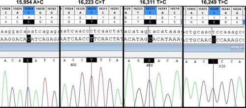 Figure 3 Four nucleotide variants that show statistically significant differences in frequency between presbycusis and control subjects.