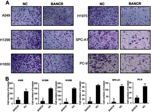 Figure 3 BANCR overexpression suppressed NSCLC cells invasion. After BANCR plasmids transfection, invasive capacity of six NSCLC cell lines was measured by Transwell migration assay (A and B). Representative data from three independent experiments represent mean ± SD. *P<0.05, **P<0.01. Abbreviations: BANCR, BRAF activated non-coding RNA; NC, negative control; NSCLC, non-small-cell lung cancer.