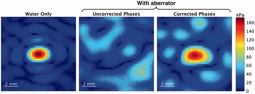 Figure 4. Hydrophone pressure measurements of the focussed ultrasound beam in water (left) and after passing through a photopolymer model without (centre) and with (right) phase aberration correction. Phase aberration correction restores the shape and position of the focus and doubles the maximum pressure achieved.