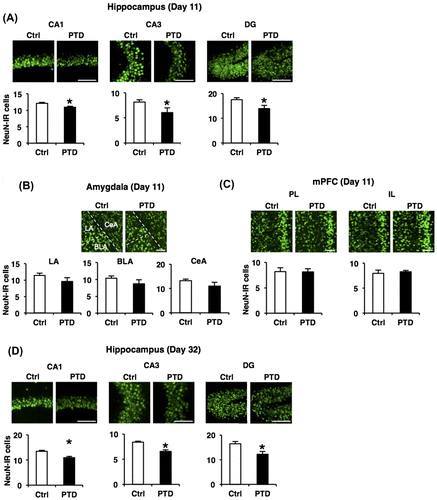 Fig. 4. Hippocampal neuronal loss in PTD mice.