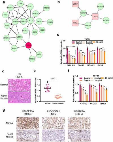 Figure 1. Differentially-Expressed genes in response to TGFβ1 stimulation in HK-2 cells and in clinical renal fibrosis tissues. (a) Interaction networks of CPT1A-related proteins in TGFβ1-induced proximal tubular cells. (b) Co-expression networks of lncRnas (green bars) and CPT1A, NCOA1, and RXRA in TGFβ1-induced proximal tubular cells. (c) HK-2 cells were stimulated with 0, 2, 5, 10, and 50 ng/ml TGFβ1 for 48 h and examined for the expression of lncRnas (FABP5P3, DGCR5, MEIS3P1, EIF3IP1). (d) H&E staining examined the histopathological features of human renal fibrosis and normal renal tissues. (e) the expression of FABP5P3 in human renal tissues was examined by real-time PCR (n = 15). (f) HK-2 cells were stimulated with 0, 2, 5, 10, and 50 ng/ml TGFβ1 for 48 h and examined for the expression of CPT1A, NCOA1, and RXRA. (g) Immunohistochemical staining detected the protein abundance of CPT1A, NCOA1, and RXRA. **p < 0.01.
