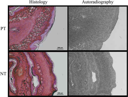 Figure 3. Light microscopy images of cryostat sections (30 μm) stained with hematoxylin-eosin and the corresponding neutron autoradiography images (10×). PT = premalignant tissue, NT = normal tissue.