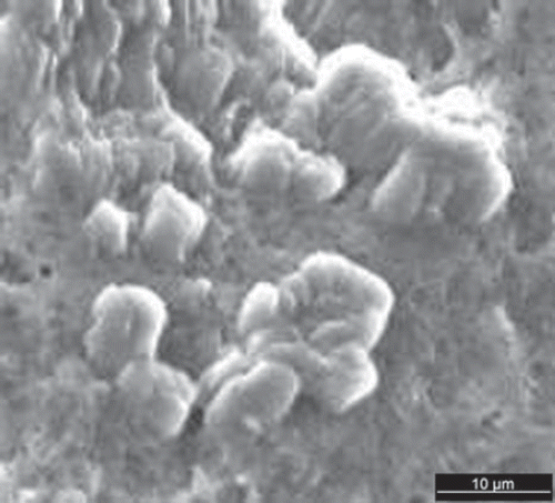 Figure 1. SEM micrograph of CEPs-loaded chitosan microparticles.