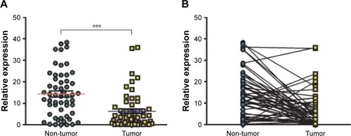 Figure 1 A and B: HMGCS2 was downregulated in ESCC tumor tissues. HMGCS2 was markedly decreased in tumor tissues when compared with paired adjacent non-tumor tissues. ***P<0.0001, paired t-test.