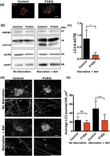 Figure 8. Motor neurons differentiated from patient-derived iPSCs show decreased autophagic flux. (a) Immunofluorescence analysis of motor neurons differentiated from iPSCs derived from patient fibroblasts carrying the P182L mutation and from a healthy control. The motor neurons were stained with the neuronal marker ISL1/Islet-1 (red). Scale bar: 20 µm. (b) Western blotting analysis of motor neurons treated and untreated with 3 h starvation and bafilomycin A1. (c) Quantification of the ratio of LC3-II (autophagy marker) over ACTB (loading control) from 3 independent western blotting experiments. Two-tailed t-test, with Tukey’s correction range test. Error bars = S.D, * = p < 0.05. (d) Immunofluorescence staining of the autophagy marker LC3 (green) in motor neurons at 20X and 63X. Scale bar: 20 µm. White arrows indicate LC3-positive puncta. (e) Quantification of LC3 puncta per 100 µm2 neurite area. One-way ANOVA, with Tukey’s correction range test. Error bars = S.D, ns = non-significant, **** = p < 0.0001.