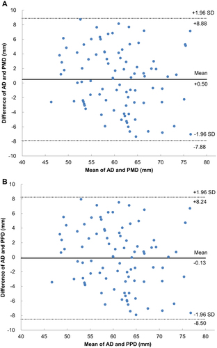 Figure 8 (A) Bland-Altman precision analysis of the measured differences between AD and PMD. (B) Bland-Altman precision analysis of the measured differences between AD and PPD.