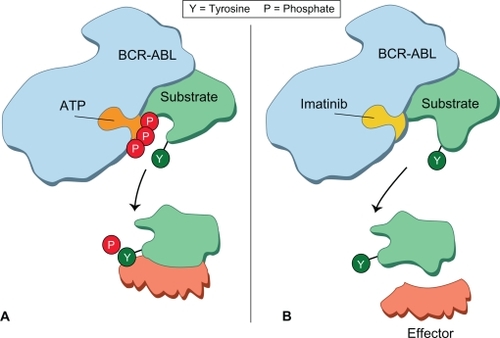 Figure 1 Mode of action of imatinib mesylate. The phosphorylation of a substrate is shown schematically. ATP occupies the pocket in the ABL component of BCR-ABL oncoprotein. The substrate then detaches itself from the BCR-ABL oncoprotein and makes functional contact with a further downstream effector molecule. When imatinib occupies the ATP binding site, it prevents phosphorylation of the substrate. This molecule in turn fails to make contact with the effector protein and the signal transduction pathway that would otherwise transmit the leukemia signal is interrupted. Reproduced with permission from Goldman and Mughal.Citation70