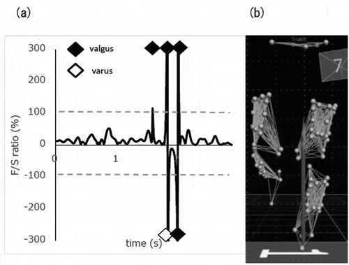 Figure 3. Detecting knee wobbling by visual observation and F/S ratio calculated as “frontal-plane angular velocity”/“sagittal-plane angular velocity” X 100. (a) The F/S ratio graph during the descending phase of one squat is shown. F/S ratio > 100 % was defined as an F/S spike, which was considered an index of quantitative KW. A positive F/S ratio indicates knee flexion angular velocity and negative angular velocity indicates knee extension angular velocity. Using absolute frontal angular velocity, a valgus F/S spike was marked with a black circle and a varus F/S spike was marked with a white circle. (b) Animation of marker movements in the frontal plane. Validation of consistency between the F/S spike and KW by visual inspection was conducted by plotting data sets as shown in this figure