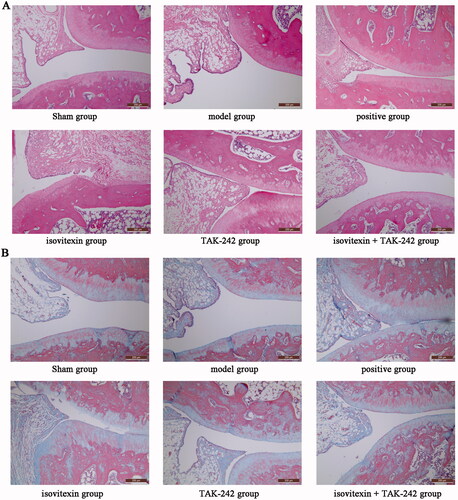 Figure 1. Effects of isovitexin on synovial tissues visualized using haematoxylin and eosin and Masson staining (×200). (A) Haematoxylin and eosin staining; (B) Masson staining.